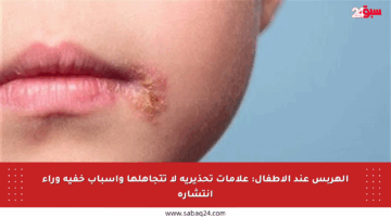 الهربس عند الأطفال: علامات تحذيرية لا تتجاهلها وأسباب خفية وراء انتشاره